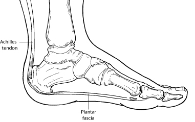 Heel Pain in Concord and Meredith, NH